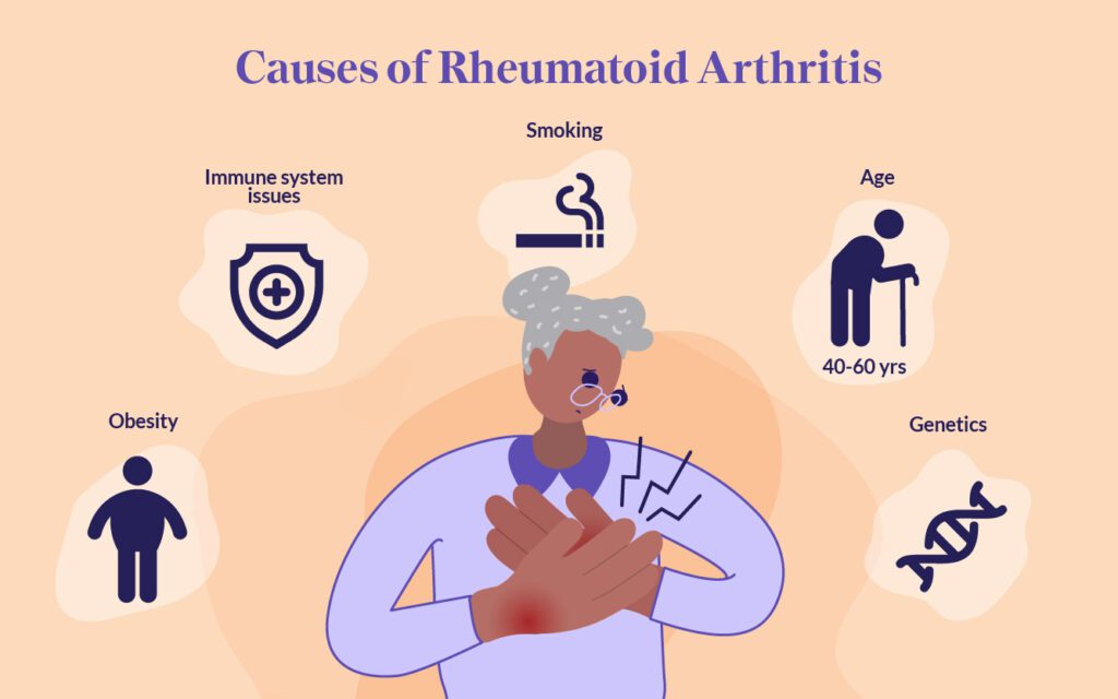 Causes of Rheumatoid Arthritis
