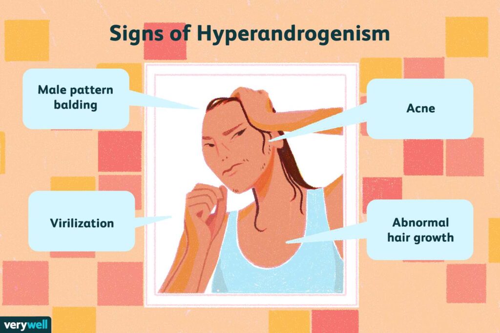 High Testosterone: Causes, PCOS, Adrenal Disorders, Symptoms