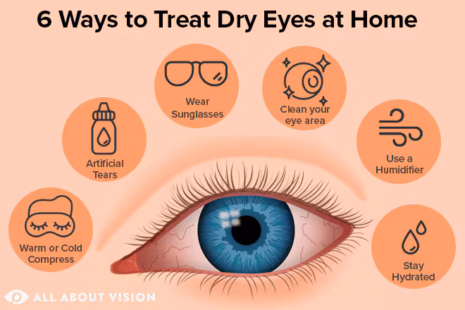 10 Natural Home Remedies for Itchy Dry Eyes
