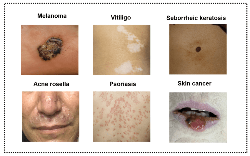 Common Skin Problems