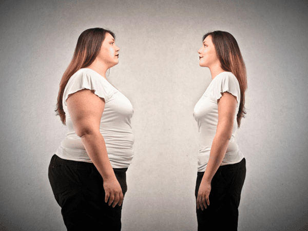 Causes of Excessive Weight Gain
