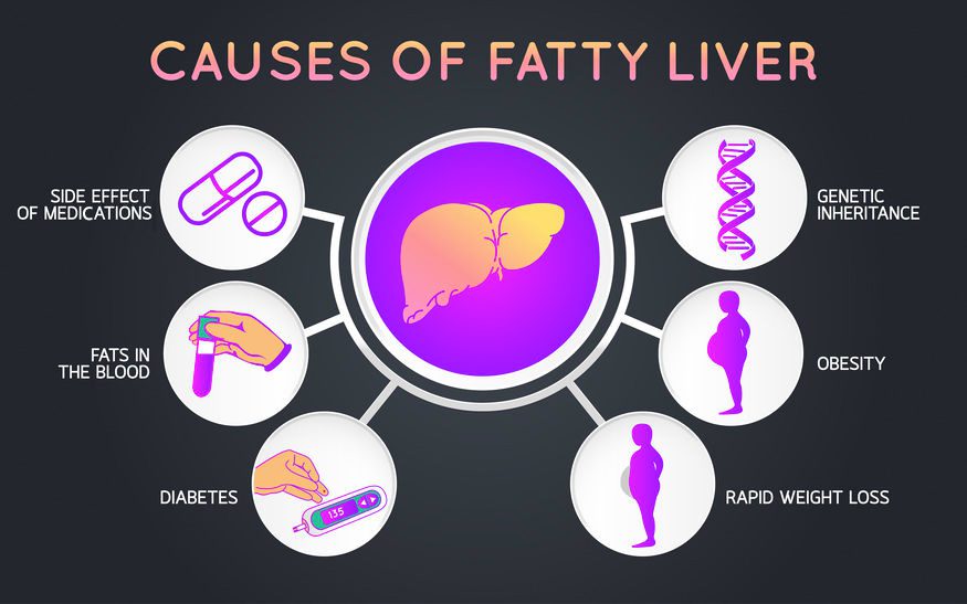Non-Alcoholic Fatty Liver Disease