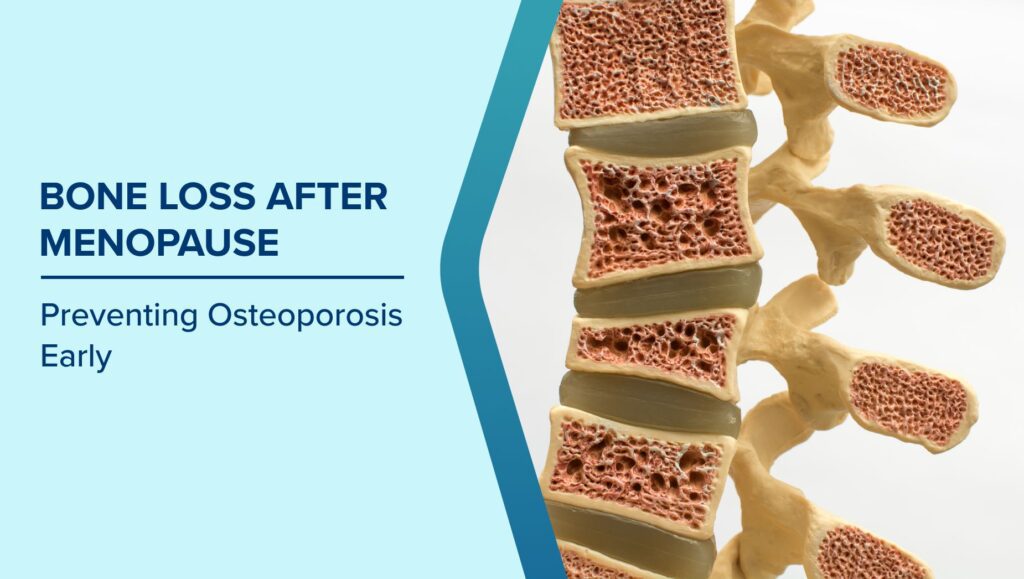 Why Bone Health Changes After Menopause